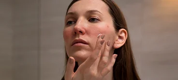 Krem ze śluzem ślimaka na trądzik pospolity i różowaty